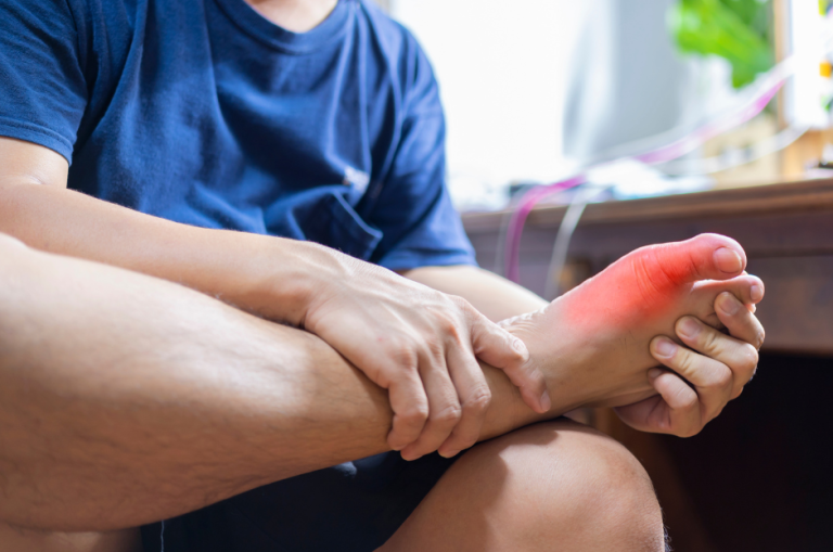 What To Do About Gout